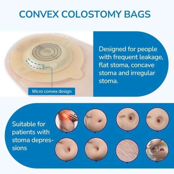 Convex Ostomy Bags - SBTZ